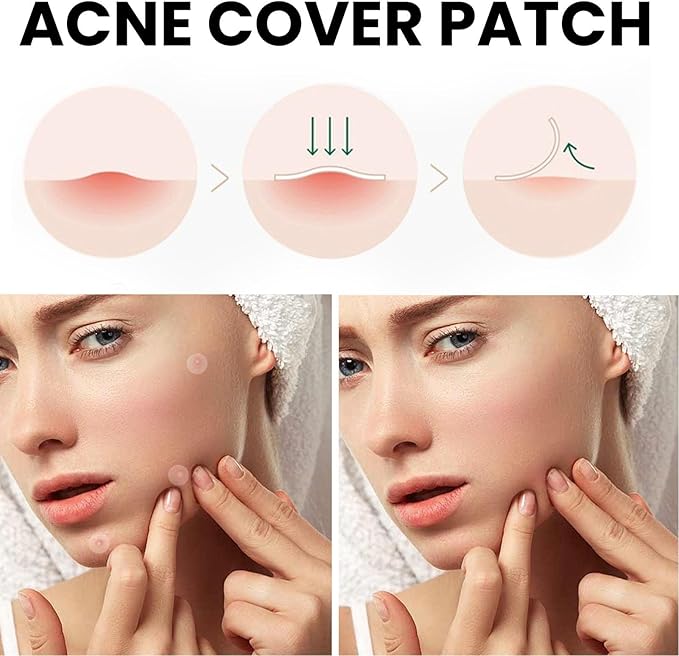 Acne Cover Patch 72pc KSA – Fast-Acting Solution for Clear and Protected Skin