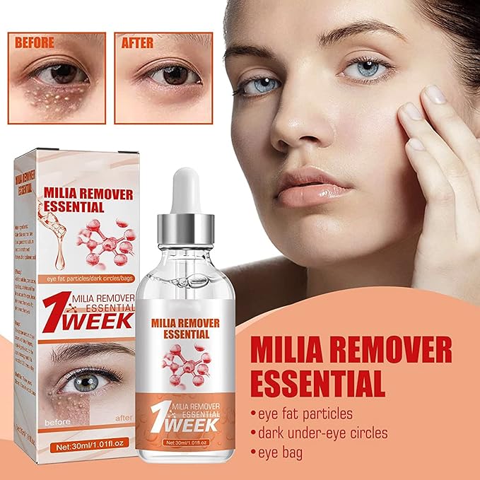 Smooth Milia Remover Serum (30ml) (KSA Only)