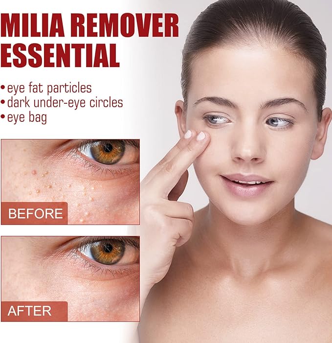 Smooth Milia Remover Serum (30ml) (KSA Only)