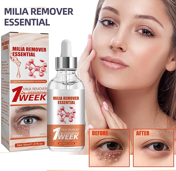 Smooth Milia Remover Serum (30ml) (KSA Only)