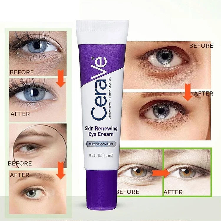 Skin Renewing Eye Cream (Original) (KSA Only)