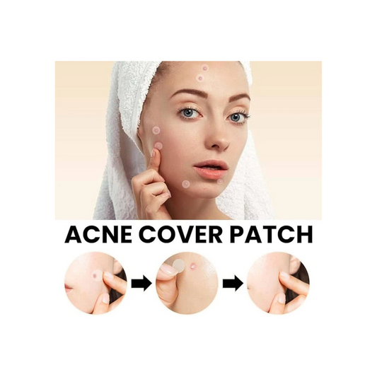 Acne Cover Patch 72pc KSA – Fast-Acting Solution for Clear and Protected Skin