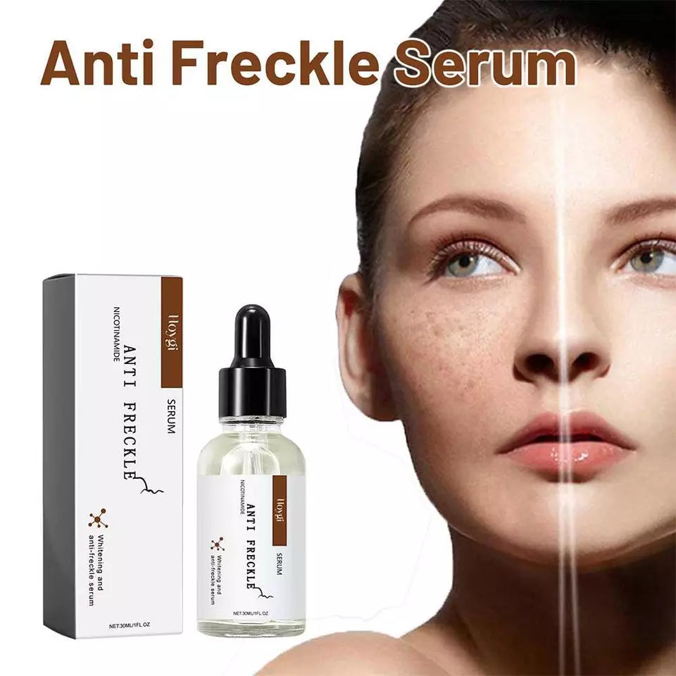 Anti Freckle Serum 30ml KSA – Targeted Solution for Clear and Even Skin Tone